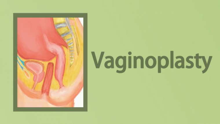 Let’s Talk About Vaginoplasty